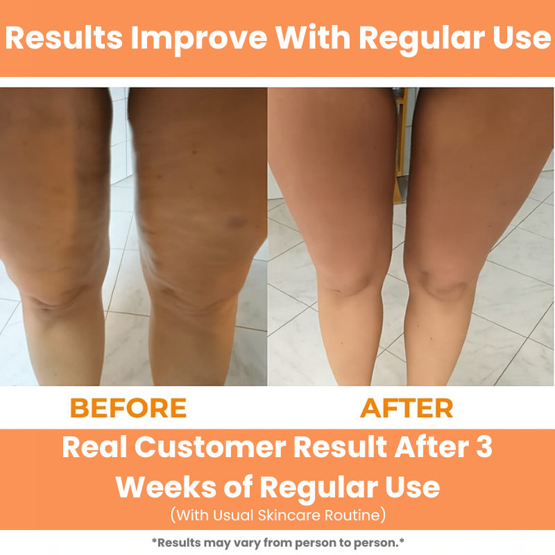 Soothesilk Manual Deep Tissue Roller